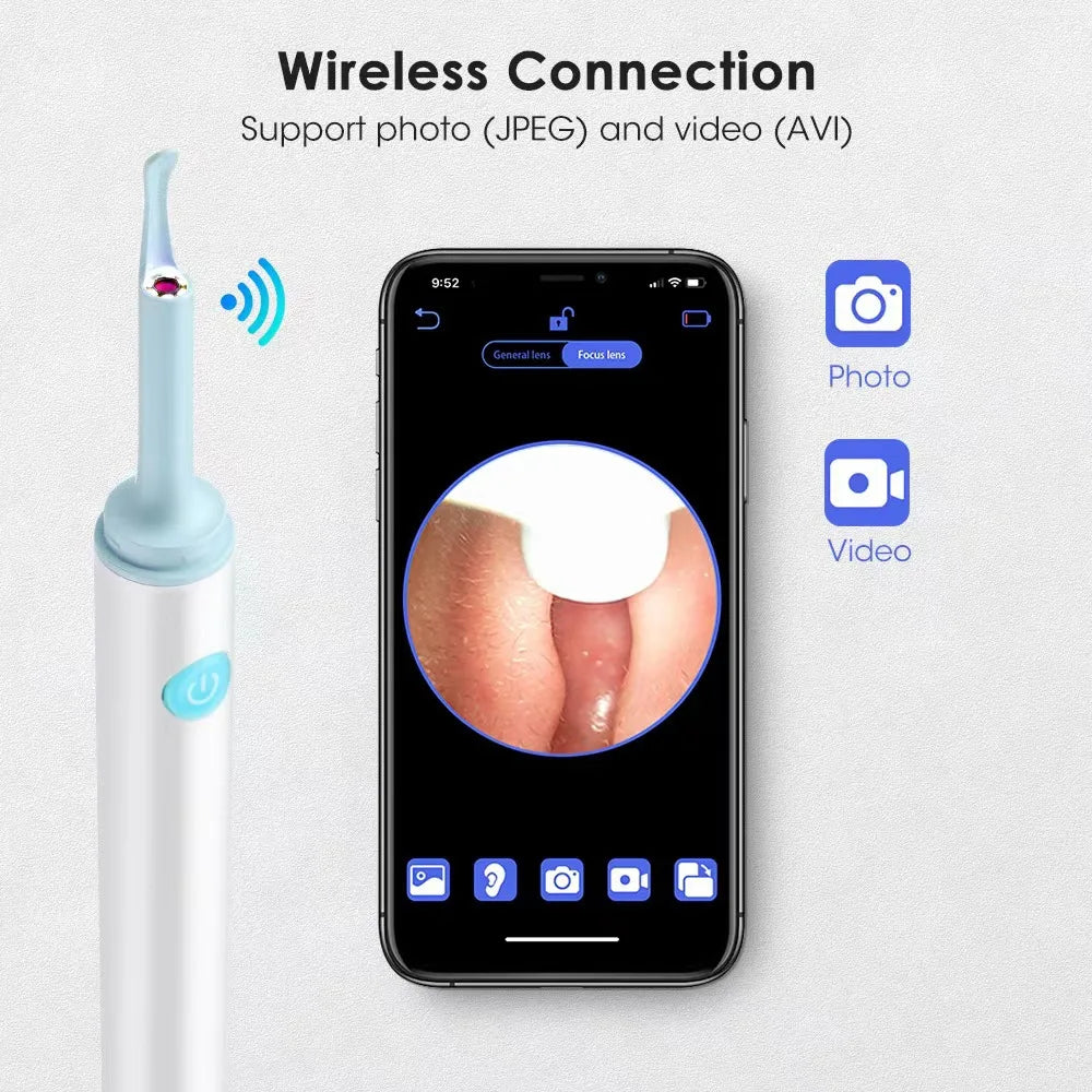 Smart Visual Ear Cleaner Hd Ear Sticks Otoscope